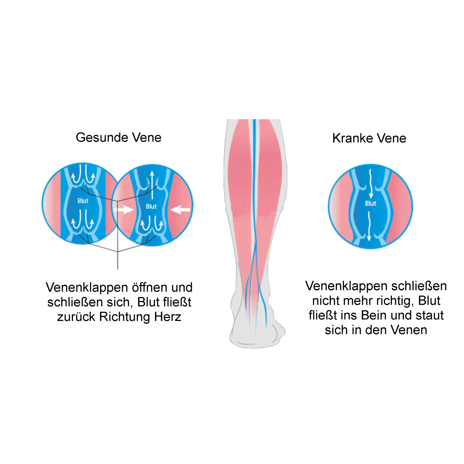 Vergleich